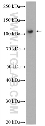 USP33 Antibody in Western Blot (WB)