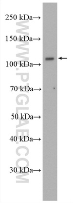 USP33 Antibody in Western Blot (WB)