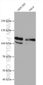 USP33 Antibody in Western Blot (WB)