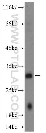 C10orf58 Antibody in Western Blot (WB)