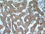 ANKZF1 Antibody in Immunohistochemistry (Paraffin) (IHC (P))
