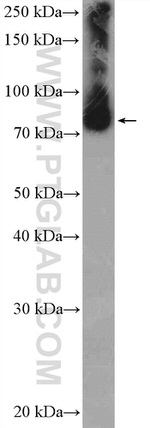 ANKZF1 Antibody in Western Blot (WB)