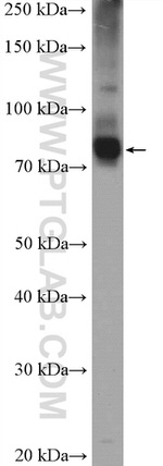 ANKZF1 Antibody in Western Blot (WB)