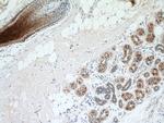 KRT34 Antibody in Immunohistochemistry (Paraffin) (IHC (P))