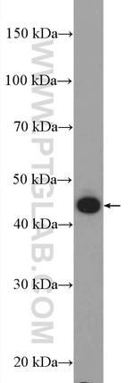 KRT34 Antibody in Western Blot (WB)