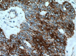 KRT34 Antibody in Immunohistochemistry (Paraffin) (IHC (P))