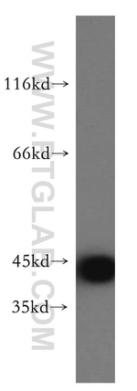 KRT34 Antibody in Western Blot (WB)