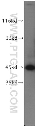 KRT34 Antibody in Western Blot (WB)