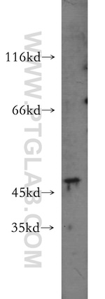 KRT34 Antibody in Western Blot (WB)
