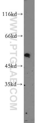 KRT34 Antibody in Western Blot (WB)