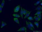 SMN Antibody in Immunocytochemistry (ICC/IF)