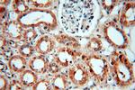 SMN Antibody in Immunohistochemistry (Paraffin) (IHC (P))