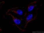 SMN Antibody in Immunocytochemistry (ICC/IF)
