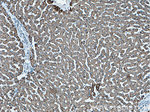 ALDH6A1 Antibody in Immunohistochemistry (Paraffin) (IHC (P))