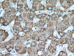 ALDH6A1 Antibody in Immunohistochemistry (Paraffin) (IHC (P))