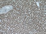 ALDH6A1 Antibody in Immunohistochemistry (Paraffin) (IHC (P))
