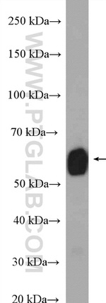 ALDH6A1 Antibody in Western Blot (WB)