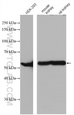 ALDH6A1 Antibody in Western Blot (WB)