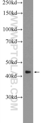RAPSN Antibody in Western Blot (WB)
