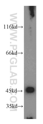 EI24 Antibody in Western Blot (WB)