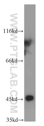 EI24 Antibody in Western Blot (WB)