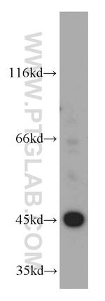 EI24 Antibody in Western Blot (WB)