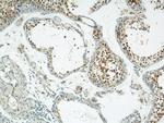 LRRC41 Antibody in Immunohistochemistry (Paraffin) (IHC (P))