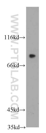 LRRC41 Antibody in Western Blot (WB)