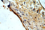 EPS8L2 Antibody in Immunohistochemistry (Paraffin) (IHC (P))