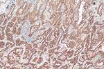 EPS8L2 Antibody in Immunohistochemistry (Paraffin) (IHC (P))