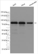 EPS8L2 Antibody in Western Blot (WB)