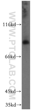 EPS8L2 Antibody in Western Blot (WB)