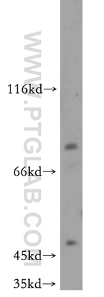 EPS8L2 Antibody in Western Blot (WB)
