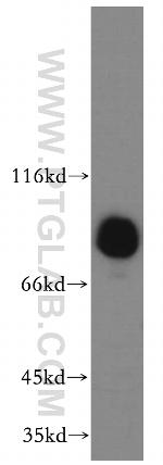 EPS8L2 Antibody in Western Blot (WB)