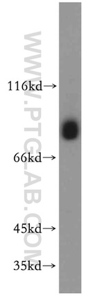 EPS8L2 Antibody in Western Blot (WB)