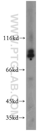EPS8L2 Antibody in Western Blot (WB)
