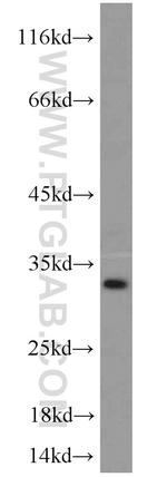 TSPAN2 Antibody in Western Blot (WB)