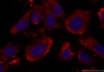 FBXW9 Antibody in Immunocytochemistry (ICC/IF)