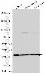 FBXW9 Antibody in Western Blot (WB)