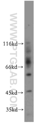 CCDC51 Antibody in Western Blot (WB)