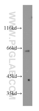 SLC37A2 Antibody in Western Blot (WB)