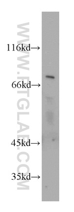 SLC37A2 Antibody in Western Blot (WB)