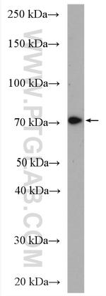 SLC37A2 Antibody in Western Blot (WB)