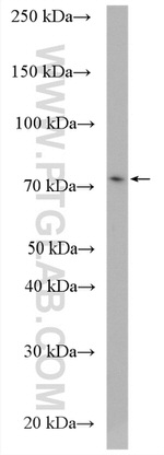 SLC37A2 Antibody in Western Blot (WB)