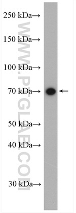 SLC37A2 Antibody in Western Blot (WB)