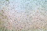 ZNF34 Antibody in Immunohistochemistry (Paraffin) (IHC (P))