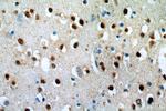 ZNF34 Antibody in Immunohistochemistry (Paraffin) (IHC (P))