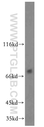 ZNF34 Antibody in Western Blot (WB)
