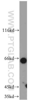 ZNF34 Antibody in Western Blot (WB)