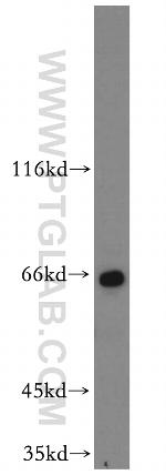 ZNF34 Antibody in Western Blot (WB)